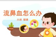 猫流鼻血的常见原因和处理方法（了解猫流鼻血的症状和保护它们的健康）
