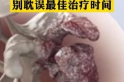 狗骨癌症状（了解狗骨癌症状，保护我们的忠诚伙伴）