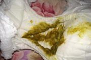 大便不畅的原因及应对方法（分析为什么很久没有拉大便以及如何解决）