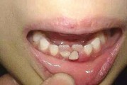 宠物以西施犬长双排牙的处理方法（健康的口腔护理让宠物更健康）