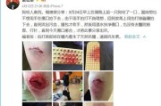 被狗抓了多久打针（预防狂犬病的关键措施及时打针）