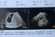 怀孕40天才测出来？解析背后的原因和可能影响