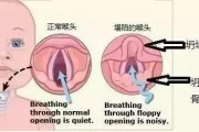 小狗气管呼呼的声音（揭秘小狗气管呼呼的原因及治疗方法）