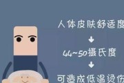 喜乐蒂烧伤和烫伤后怎么办（宠物的安全需要我们用心呵护）