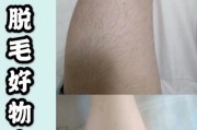 贵宾脱毛，选择什么牌子好？（从效果、安全和价格三方面综合考虑，选择合适的贵宾脱毛产品）