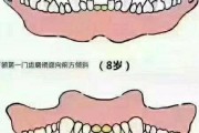 通过牙齿状况判断狗狗年龄的方法（简单易学，1分钟教会你如何判断狗狗年龄）