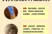 解决狗狗皮炎的有效药物治疗方法（探索有效治疗狗狗皮炎的药物及护理措施，）