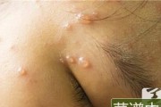 水狗（探索水狗的外貌、习性及保护之道）