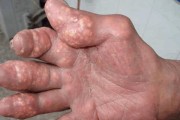 温犬细的症状及其影响（了解温犬细的症状，保护宠物健康）