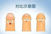 小JJ发炎的原因及治疗方法探究（探寻小JJ发炎的主要原因和有效治疗方法，帮助解决相关问题）
