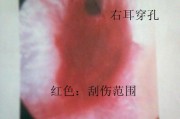 耳廓流血的处理方法与药物擦拭（耳廓流血的药物擦拭步骤及药品推荐）