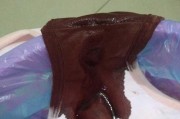 狗狗产后恶露过多的原因（了解恶露过多的危害，保护母犬健康）