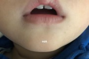 恶霸犬长蛀牙，如何预防与治疗？（宠物健康必修，学会对付恶霸犬的蛀牙问题！）