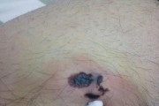 狗接受了血清治疗的奇妙过程（探秘狗接受血清治疗的关键步骤和效果）