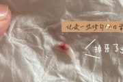 宠物泰迪掉牙的注意事项（保持宠物口腔健康，让泰迪远离牙齿问题）