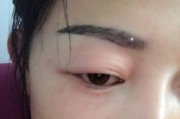 眼睑红肿的原因和处理方法（了解红肿眼睑的症状和预防措施）