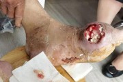 狗狗痛风，如何预防和治疗？（从病因到预防，让宠物远离痛风的烦恼）