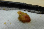 探秘猫咪便便虫卵